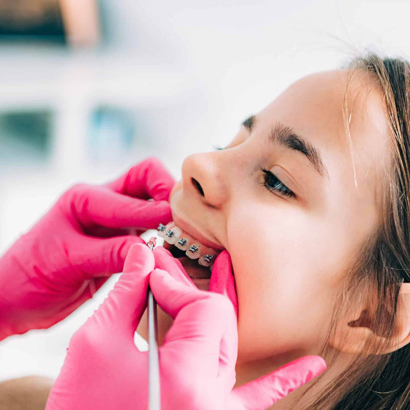 Children's Orthodontics - Braces - Peterborough