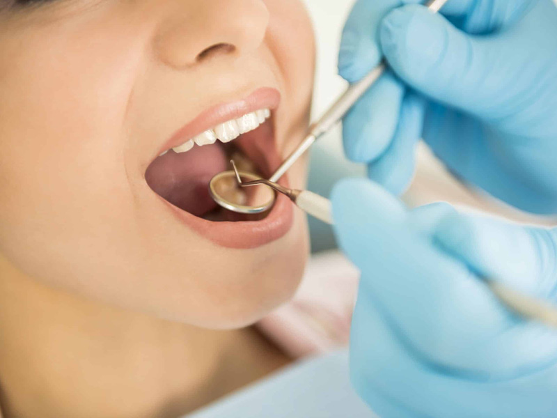 Root Canal Treatment - Peterborough